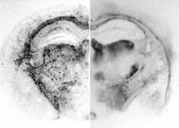 Distribution différentielle du prion dans le cerveau entre 2 souches