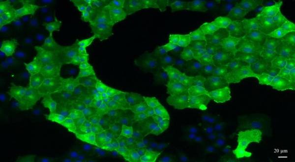 Cellules épithéliales de rein de lapin produisant la protéine prion normale d’une espèce au choix