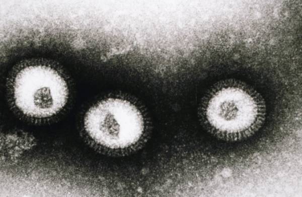 photo en microscopie du virus Influenza