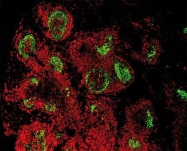 Immunodétection des prions dans la rate de souris expérimentalement infectées. Vert : prions ; Rouge : lymphocytes B (anticorps B220).